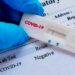 Autorizaron a vender en farmacias el nuevo test rápido de covid-19