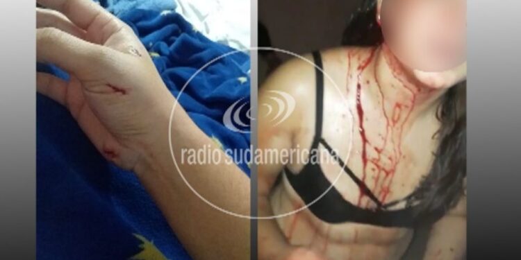 Bella Vista: Investigan violento ataque a una mujer con piedras y cuchillo