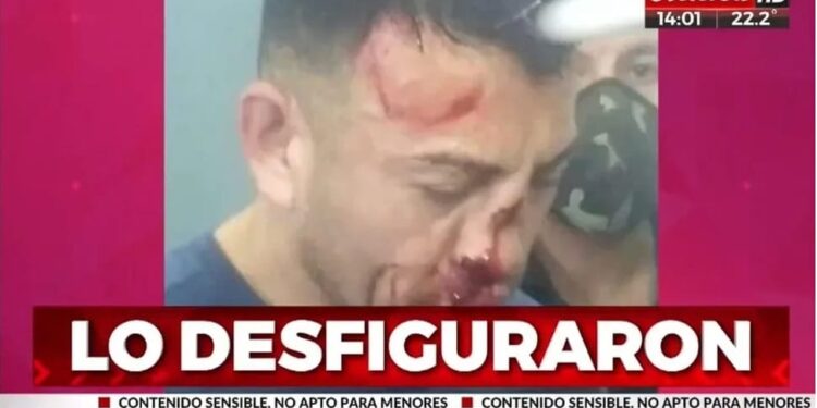 Presos desfiguraron a trompadas al femicida de Analía Maldonado