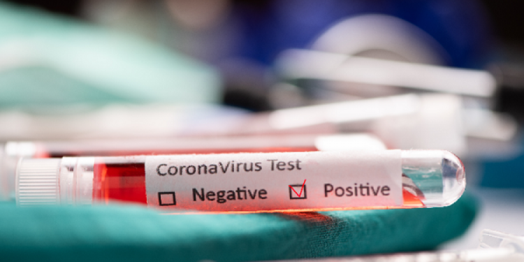 Esquina: 13 nuevos casos de coronavirus