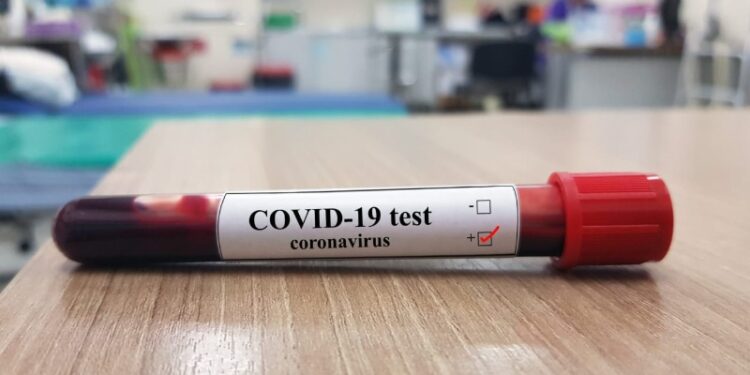 Esquina: 6 casos nuevos de coronavirus y ya son 51 los activos