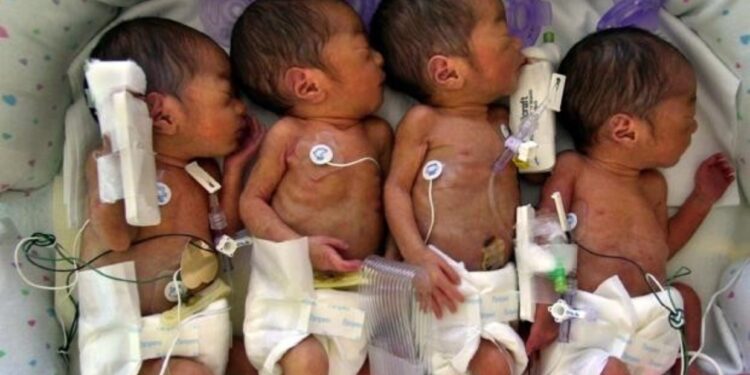 Una mujer esperaba septillizos, pero dio a luz a nueve bebés