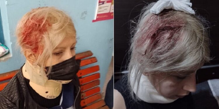 La plata: Cayó una ventana e hirió a una maestra que daba clases