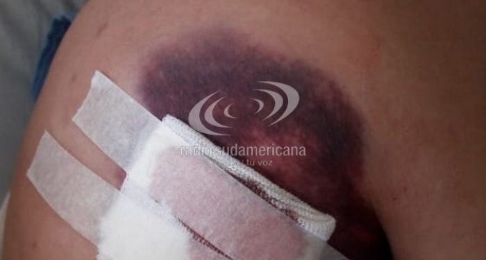 Corrientes: Tremendas imágenes del periodista apuñalado en un intento de robo