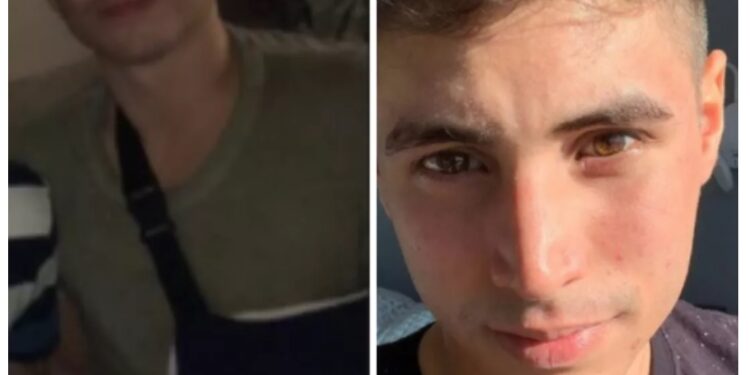 Corrientes: Se recibió de abogado y en los festejos lo terminaron fracturando