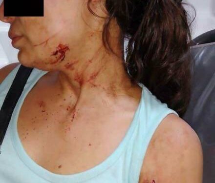 Su ex pareja trató de matarla con un machete