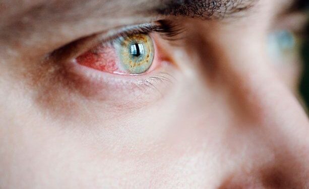 Cómo saber si tuviste Covid-19 y no te diste cuenta