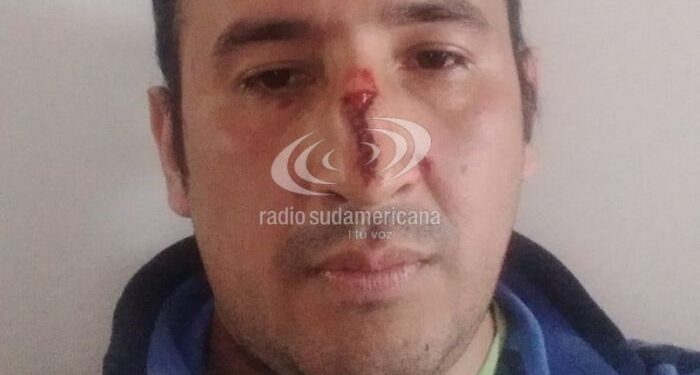 Esquina: un hombre denunció que fue agredido por su hermana
