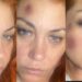 Golpes y moretones: la acusación de violencia de género de una ex Bandana