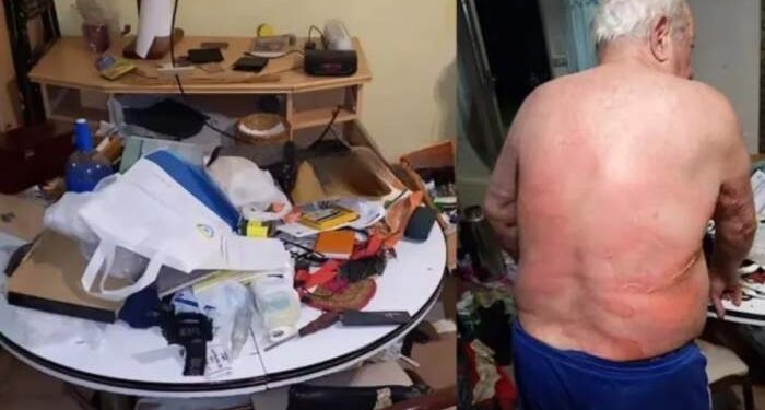 Brutal entradera: torturaron a un jubilado con agua hirviendo para robarle