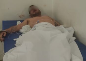 Un hombre desfiguró a golpes a su hijastra de 7 años: los vecinos casi lo linchan