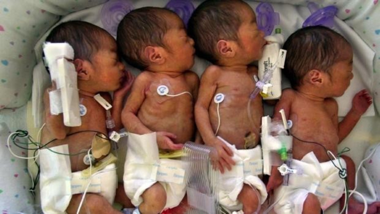 Una mujer esperaba septillizos, pero dio a luz a nueve bebés