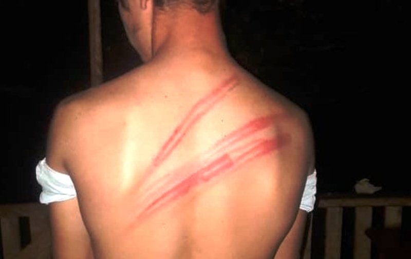 Una mujer agarró a latigazos a un compañerito de su hija: "Fuera de mi casa"