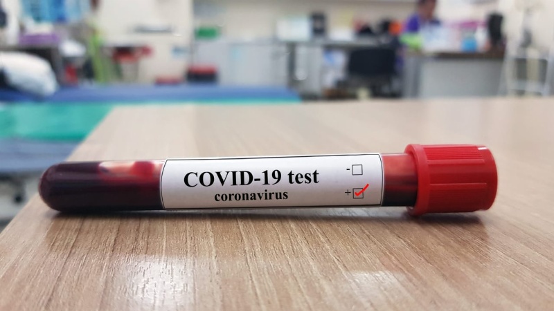 Esquina: 31 casos de coronavirus en un día