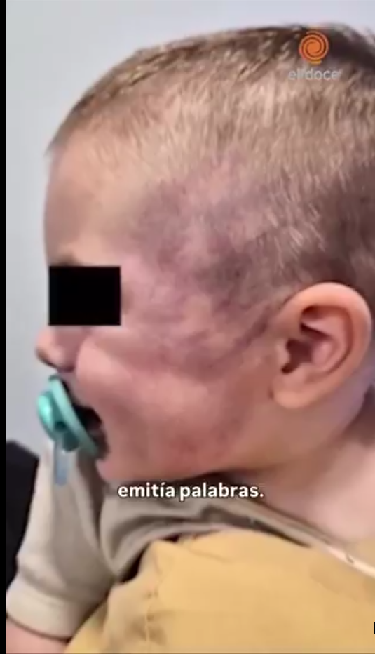 Un bebé de 8 meses fue brutalmente golpeado en un jardín de Córdoba