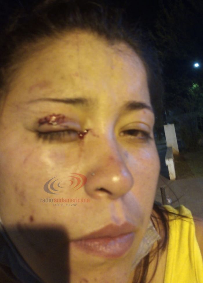Corrientes: Su vecino le dio tremenda paliza con la palita para el asado