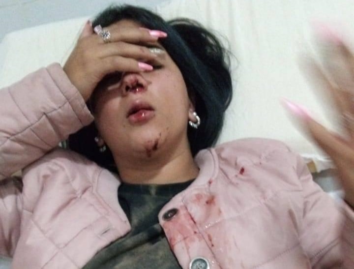 Goya: delincuente atacó a golpes a una joven para robarle