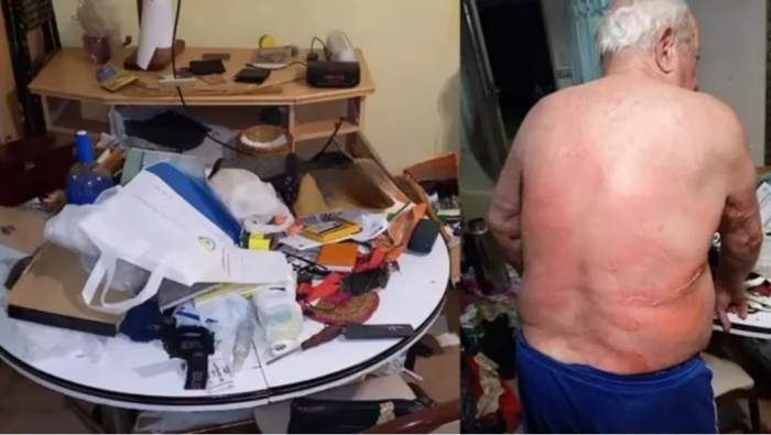 Brutal entradera: torturaron a un jubilado con agua hirviendo para robarle