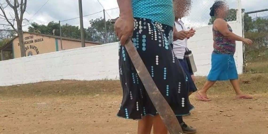 Una mujer entró durante la noche a la casa de su ex y le cortó la cara a su exsuegra con un machete