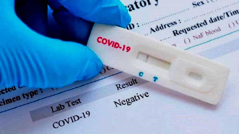 Autorizaron a vender en farmacias el nuevo test rápido de covid-19