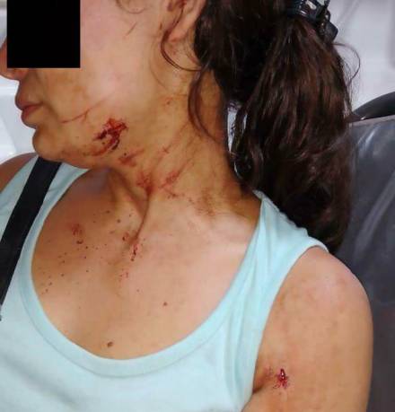 Su ex pareja trató de matarla con un machete
