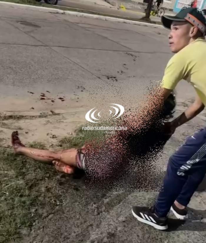 Joven que perdió el brazo denunció que piden dinero en su nombre