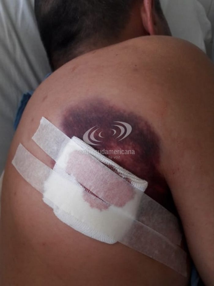 Corrientes: Tremendas imágenes del periodista apuñalado en un intento de robo
