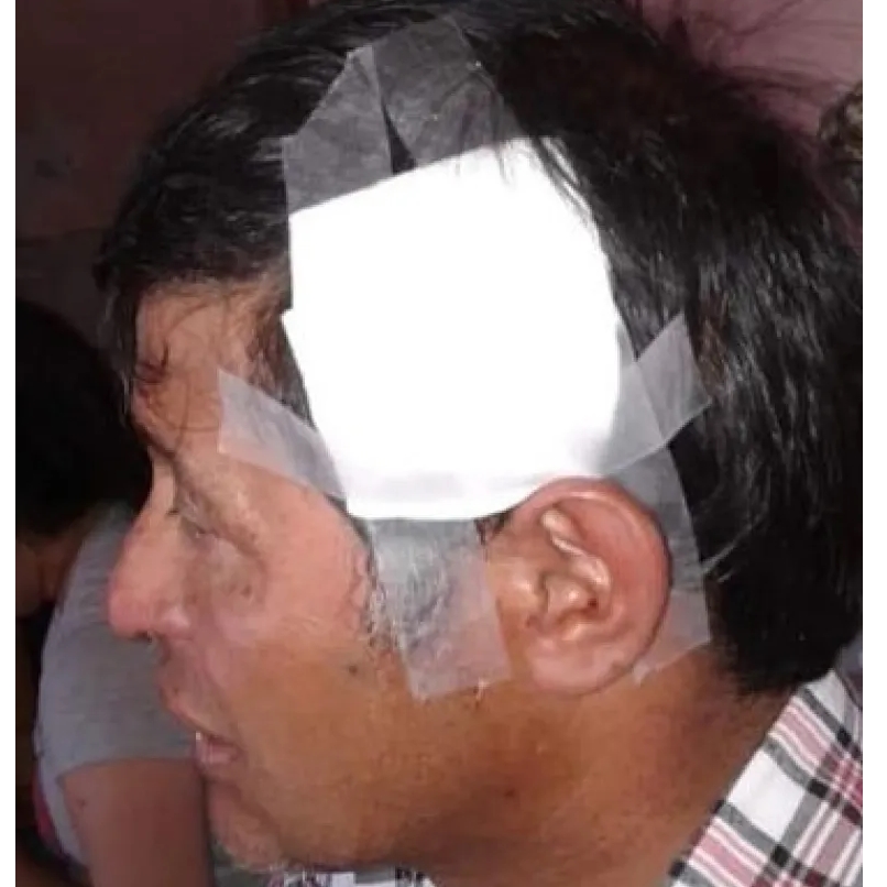 Empleado municipal fue brutalmente golpeado por cuatro personas