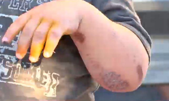 Motochorros arrastran a un bebé media cuadra en un intento de robo
