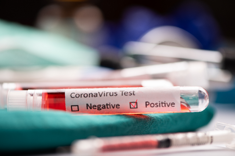 Esquina: 13 nuevos casos de coronavirus