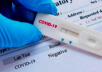 Autorizaron a vender en farmacias el nuevo test rápido de covid-19