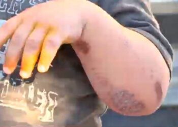 Motochorros arrastran a un bebé media cuadra en un intento de robo