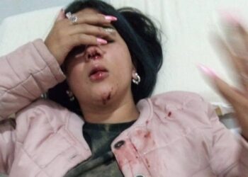 Goya: delincuente atacó a golpes a una joven para robarle