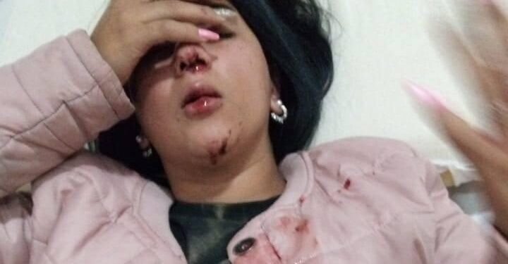 Goya: delincuente atacó a golpes a una joven para robarle