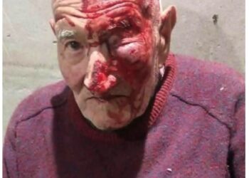 Mercedes: golpearon a un anciano hasta dejarlo inconsciente