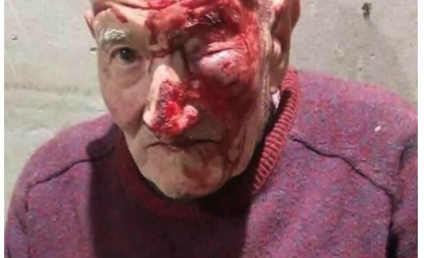 Mercedes: golpearon a un anciano hasta dejarlo inconsciente