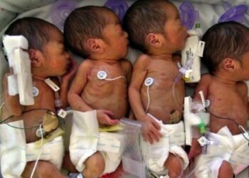 Una mujer esperaba septillizos, pero dio a luz a nueve bebés
