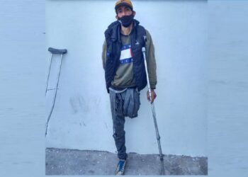 Sufrieron amputaciones en sus piernas y ahora roban en muletas