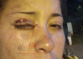 Corrientes: Su vecino le dio tremenda paliza con la palita para el asado