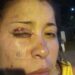 Corrientes: Su vecino le dio tremenda paliza con la palita para el asado