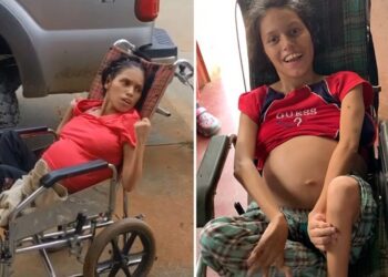 Una joven discapacitada quedó embarazada tras sufrir una violación: la familia decidió que tenga el bebé