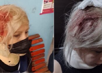 La plata: Cayó una ventana e hirió a una maestra que daba clases