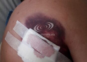 Corrientes: Tremendas imágenes del periodista apuñalado en un intento de robo
