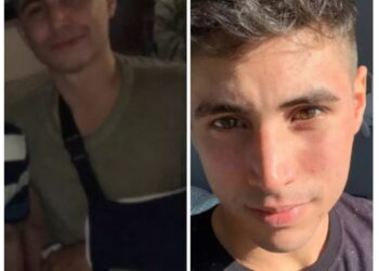 Corrientes: Se recibió de abogado y en los festejos lo terminaron fracturando