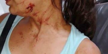 Su ex pareja trató de matarla con un machete