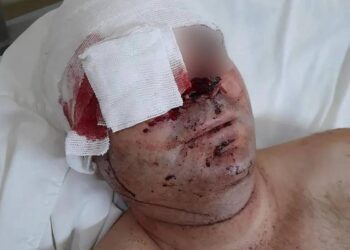 Uno de los prefectos baleados cerca de Monte Caseros recibió 50 perdigones en el rostro y perdió la visión