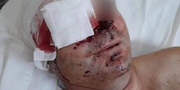 Uno de los prefectos baleados cerca de Monte Caseros recibió 50 perdigones en el rostro y perdió la visión