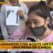 “Que la empleada dé la cara”, reclamó la mamá de la nena quemada con aceite en un restaurante