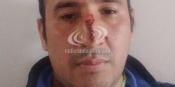Esquina: un hombre denunció que fue agredido por su hermana
