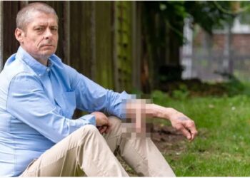 Tuvo su pene en el brazo por 6 años y ahora se lo pusieron en el lugar correcto: “Me siento un hombre de verdad”